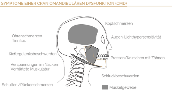 CMD, Zahnarzt Böblingen, Dr. Wagner